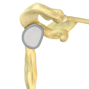 Shoulder Stabilization Procedure